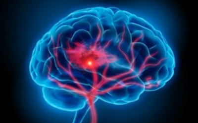 Neurovascular Imaging