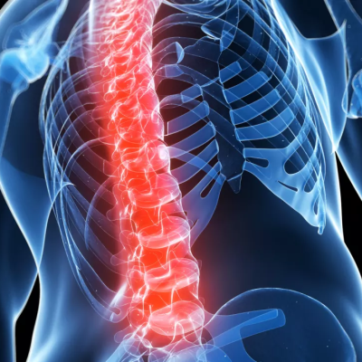 Spinal-Interventions